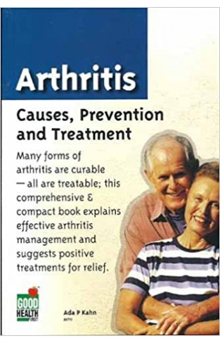 Arthritis: Causes, Prevention And Treatment