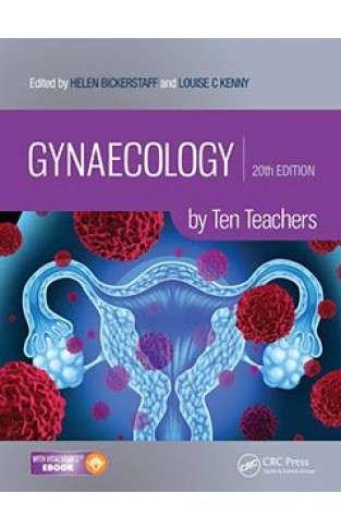 Gynaecology by Ten Teachers, 20th Edition - PB
