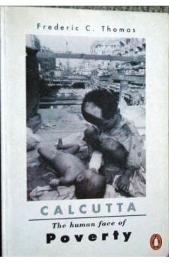 Calcutta: The human face of Poverty