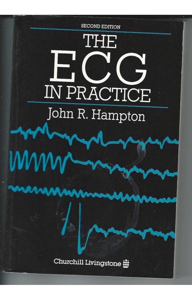 The Ecg in Practice