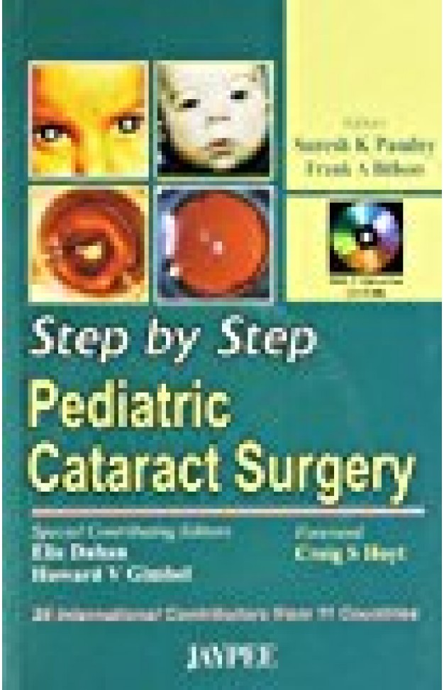 Step By Step Pediatric Cataract Surgery